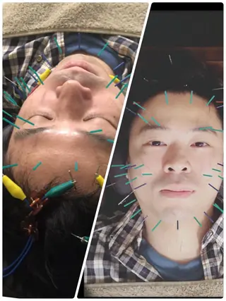 表参道鍼灸院K 美容鍼🔮ララピールのエステ・リラクイメージ