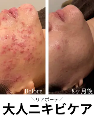 浜野 恵美のエステ・リラクイメージ