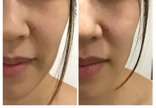 武蔵浦和　小顔矯正 リーフ　　武蔵浦和店のエステ・リラクイメージ