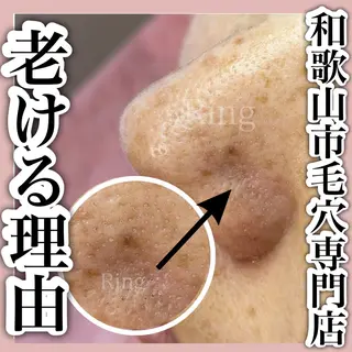 和歌山　毛穴専門店 Ringのエステ・リラクイメージ