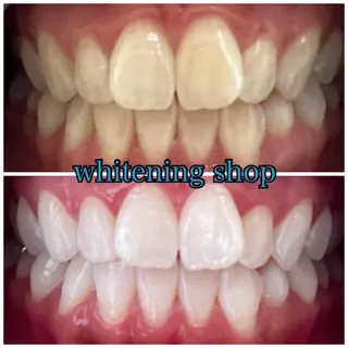 メンズ ホワイトニング ショップ船橋２号店のエステ・リラクイメージ