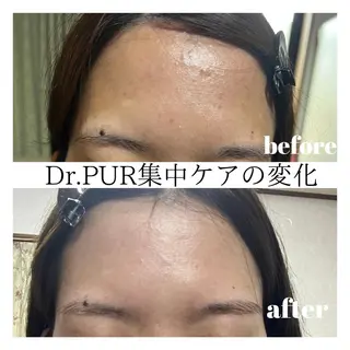 トータルビューティーサロンハルプラス所属・美肌・リラク ハルプラスのエステ・リラクイメージ