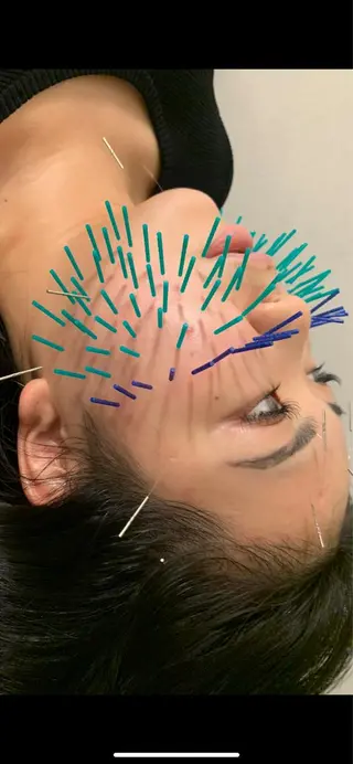 表参道鍼灸院K 美容鍼🔮ララピールのエステ・リラクイメージ