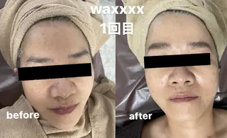 メンズ Epina 千葉店 【エピナ】のエステ・リラクイメージ