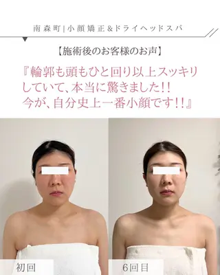 ドライヘッドスパ専門店 SIESTA所属・ドライヘッドスパ 専門店SIESTAのエステ・リラクイメージ