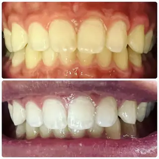 LOVE ホワイトニング戸辺のその他イメージ