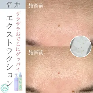 毛穴肌質ケアサロン Yourmeユアミーのエステ・リラクイメージ