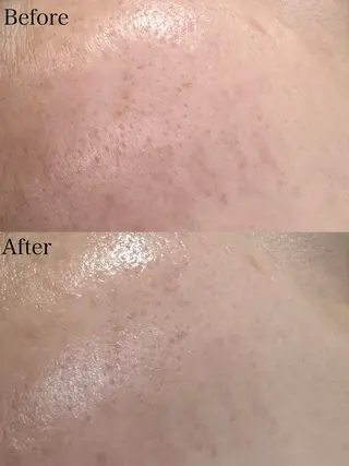 beautysalon LIMOA所属・松本 愛絵理のエステ・リラクイメージ