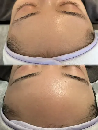 頭皮・薄毛改善サロン ｜眉毛｜痩身のエステ・リラクイメージ