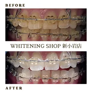 ホワイトニング ショップ新小岩店のその他イメージ