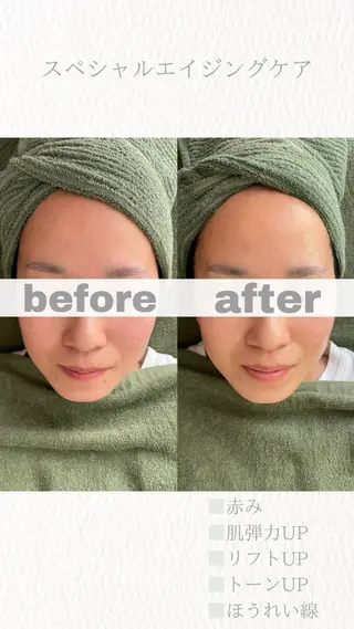 uru.所属・林田 圭純のエステ・リラクイメージ