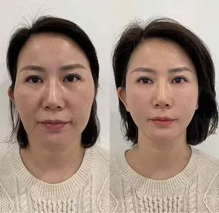 ネイル aliaハイフ&水光ジェットサロン所属・aliaハーブ水光店 エステティシャン募集のエステ・リラクイメージ