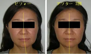 吉信 　のエステ・リラクイメージ