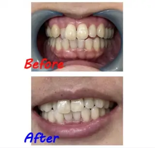 セルフホワイトニングサロン　ラヴィアン所属・ホワイトニングサロン La vie enのその他イメージ