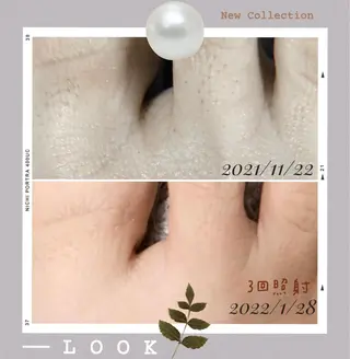 脱毛サロン NR エヌアール所属・NR Nara yukiのエステ・リラクイメージ