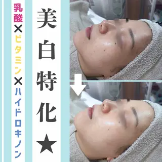 |ピーリング・毛穴| soina神楽坂のエステ・リラクイメージ