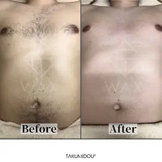 JYUNESU所属・眠れるワックス脱毛 ・銀座のエステ・リラクイメージ