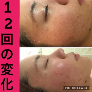 ミディアム カラー パーマ ヘアアレンジ メンズ キッズ ネイル マツエク・マツパ ニキビ・肌質改善専門 ♡人生が変わるサロンのエステ・リラクイメージ