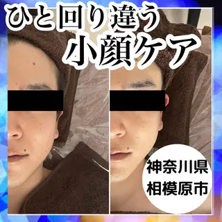 毛穴/肌質改善サロン クレアベレッツァのエステ・リラクイメージ