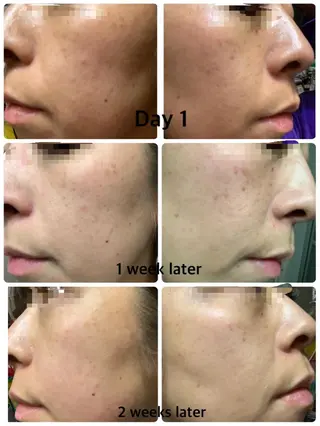 eyelist Asamiのマツエク・マツパデザイン