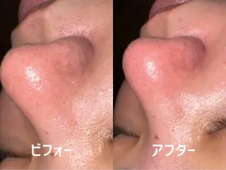 愛音💜BELZE✮ ローマピンク/ハーブのその他イメージ