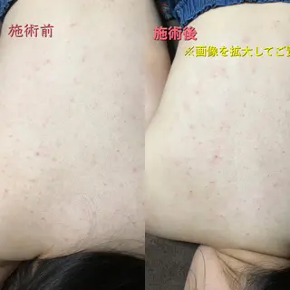 La.pport ラポールのエステ・リラクイメージ