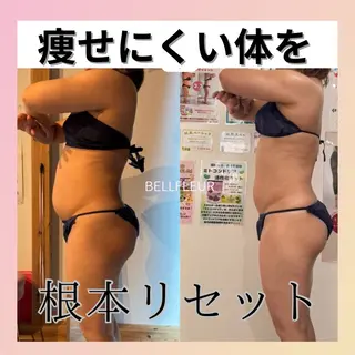 ベルフルール所属・鈴木 悠佳梨のエステ・リラクイメージ