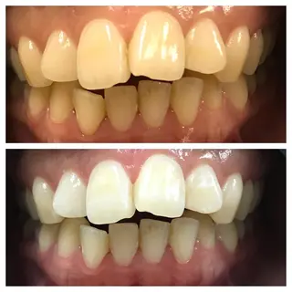 エレナラッシュ 北本店のその他イメージ