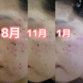 菊地 恵美のエステ・リラクイメージ