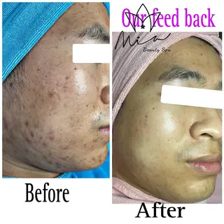 Mia beauty所属・MiA Beautyのエステ・リラクイメージ