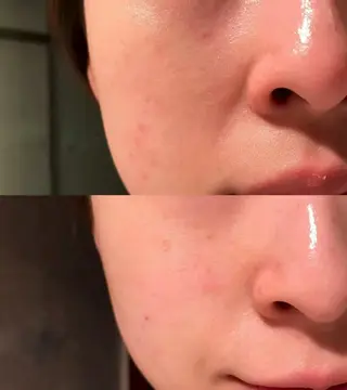 ネイル aliaハイフ&水光ジェットサロン所属・aliaハーブ水光店 エステティシャン募集のエステ・リラクイメージ