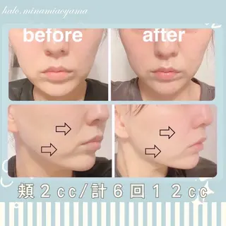 小顔痩身HALO 二宮早織のエステ・リラクイメージ