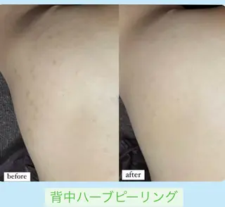 ベラージュ【美背中・ 美尻・フェイシャル】のエステ・リラクイメージ