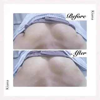 バスト専門Kiana 風のエステ・リラクイメージ