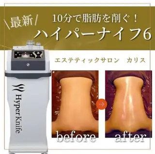 ハイパーナイフ痩身 Misakiのエステ・リラクイメージ
