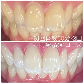 PLATINUM Beauty 横浜店所属・ホワイトニングルーム 横浜店のその他イメージ