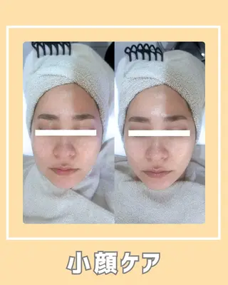 |ピーリング・毛穴| soina神楽坂のエステ・リラクイメージ