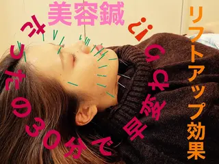 鍼灸整体院　蕾所属・美容鍼 蕾【谷町六丁目】のエステ・リラクイメージ