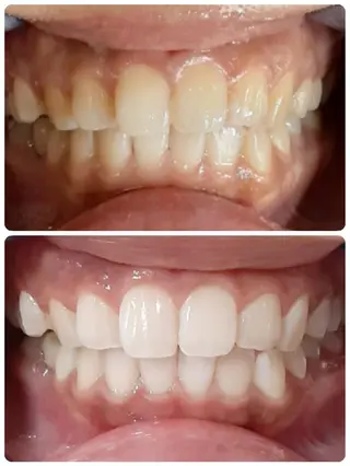 五十嵐 蓮のその他イメージ