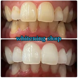 ホワイトニング ショップ吉祥寺店のエステ・リラクイメージ