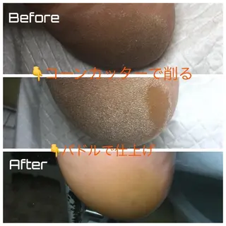 ドクターネイル爪革命 takahashiのその他イメージ