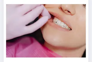 口腔エステ リハセラのエステ・リラクイメージ