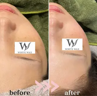 セルフホワイトニング　アデル所属・戸嶋 菫のエステ・リラクイメージ