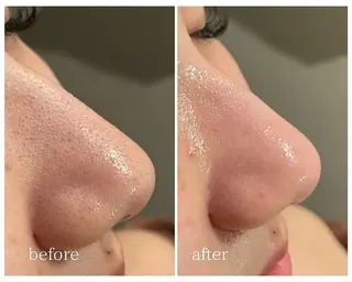 ツキイチ肌管理 ivy careのエステ・リラクイメージ