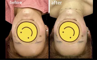 小顔と腸の専門店 ラクーラビューティのエステ・リラクイメージ