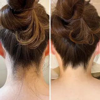 うなじ脱毛/美肌脱毛 LABELのエステ・リラクイメージ