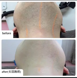 メンズ ☀️Akala☀️ メンズ脱毛のエステ・リラクイメージ