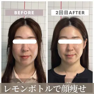 【小顔リフト×小顔矯正専門店】RED所属・猿渡 ひかるのエステ・リラクイメージ