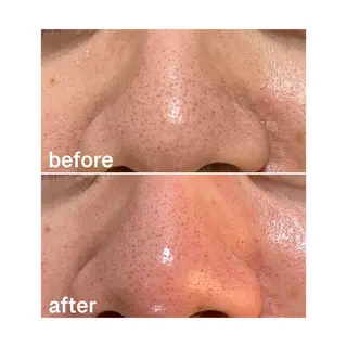 アロマ•ピーリング SalonYokoのその他イメージ