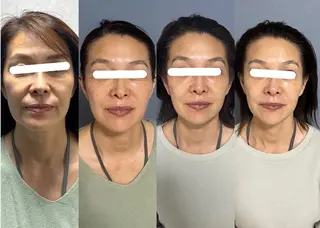 Lyf salon.所属・Lyf salon.のエステ・リラクイメージ